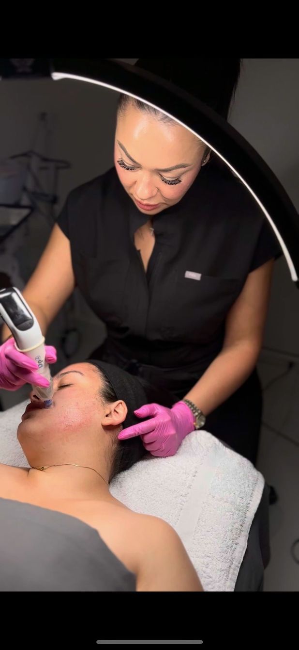 Treatment photo from HydraHive’s official website; no outcome implied